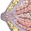 breast implant icon